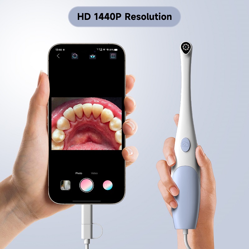 Oral Endoskop Kamera 1440P Fot - Photography Lighting Products incelemesi ve fiyatı