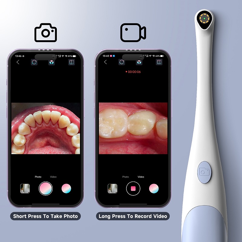 Oral Endoskop Kamera 1440P Fot - Photography Lighting Products incelemesi ve fiyatı